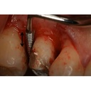 GDC Schluger Bone File 6 Fs910s_4.png