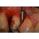 GDC Schluger Bone File 6 Fs910s_5.png