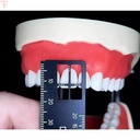 ET Dental Precision Measuring Ruler_8.jpg