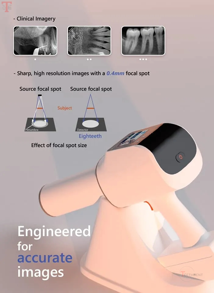 Eighteeth Hyperlight Portable Xray Machine_7.jpg