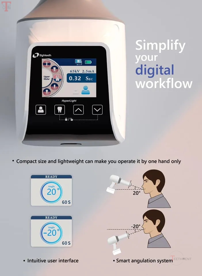Eighteeth Hyperlight Portable Xray Machine_9.jpg
