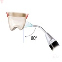EndoKing Prophyshine Air Polisher_5.jpg