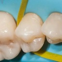 Eve Flexi Strips 9010_4.jpg