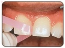 Eve Flexi Strips 9010_5.jpg