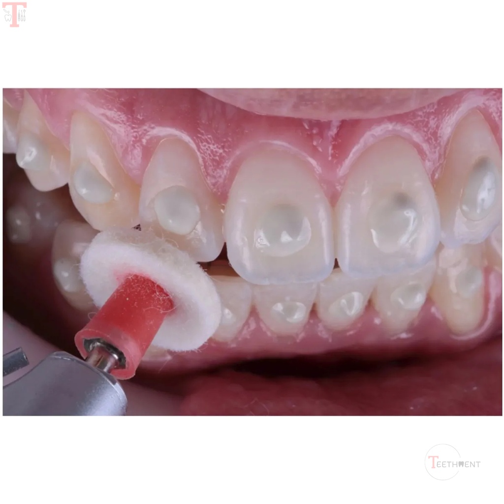 FGM Diamond Master Finishing  Polishing Kit_3.jpg