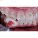 FGM Diamond Master Finishing  Polishing Kit_3.jpg