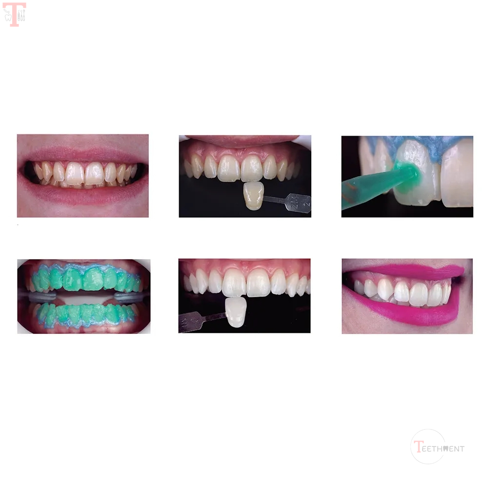 FGM Whiteness HP Automixx 35_4.jpg