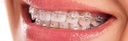 Fox Ligature Ties_5.jpg