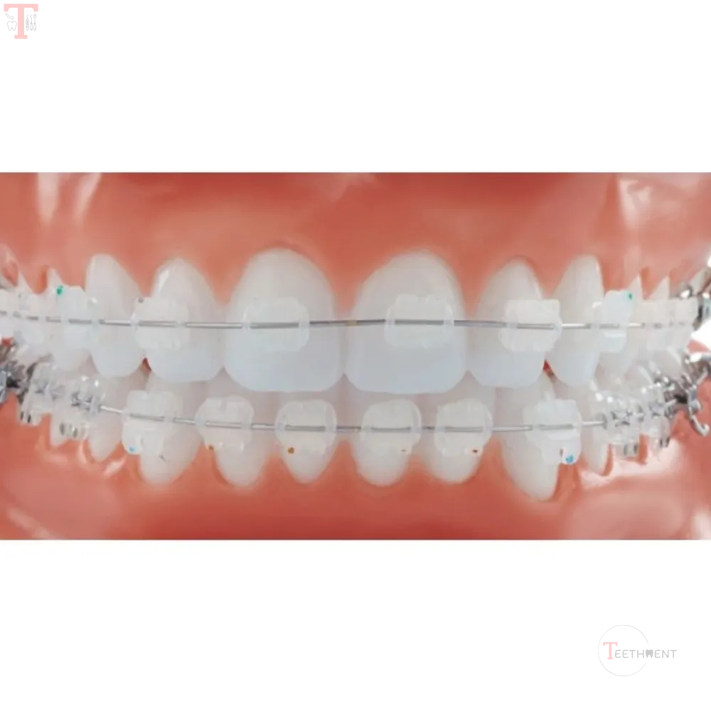 Fox Passive SL Ceramic MBT 022 Brackets Kit  FSLCM22_4.jpg