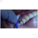 GC Dentin Conditioner_4.jpg