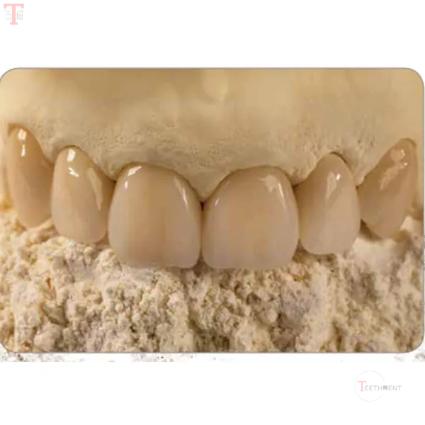 GC Fuji Rock Ep Golden Brown 5kg_3.jpg