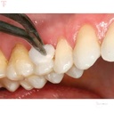 GC Fuji Varnish 5gm_4.jpg