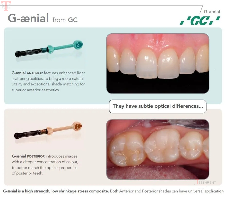 GC GAenial Anterior_4.jpg