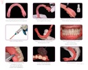 GC Reline II Soft Intro Kit_10.jpg