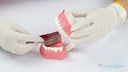 GDC Adjustable Dentulous Perforated Itrldpa_5.jpg