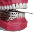 GDC Adjustable Dentulous Perforated Itrldpa_6.jpg