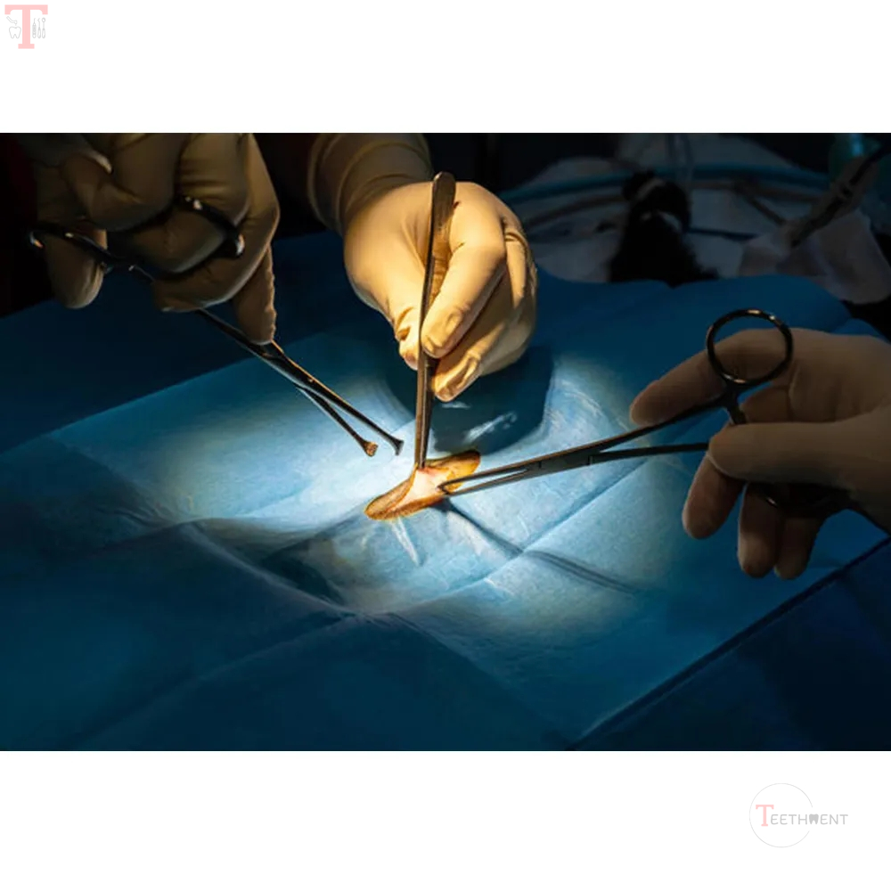 GDC Allis Forceps 5x6 15cm TFS_5.jpg