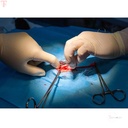GDC Allis Forceps 5x6 15cm TFS_6.jpg