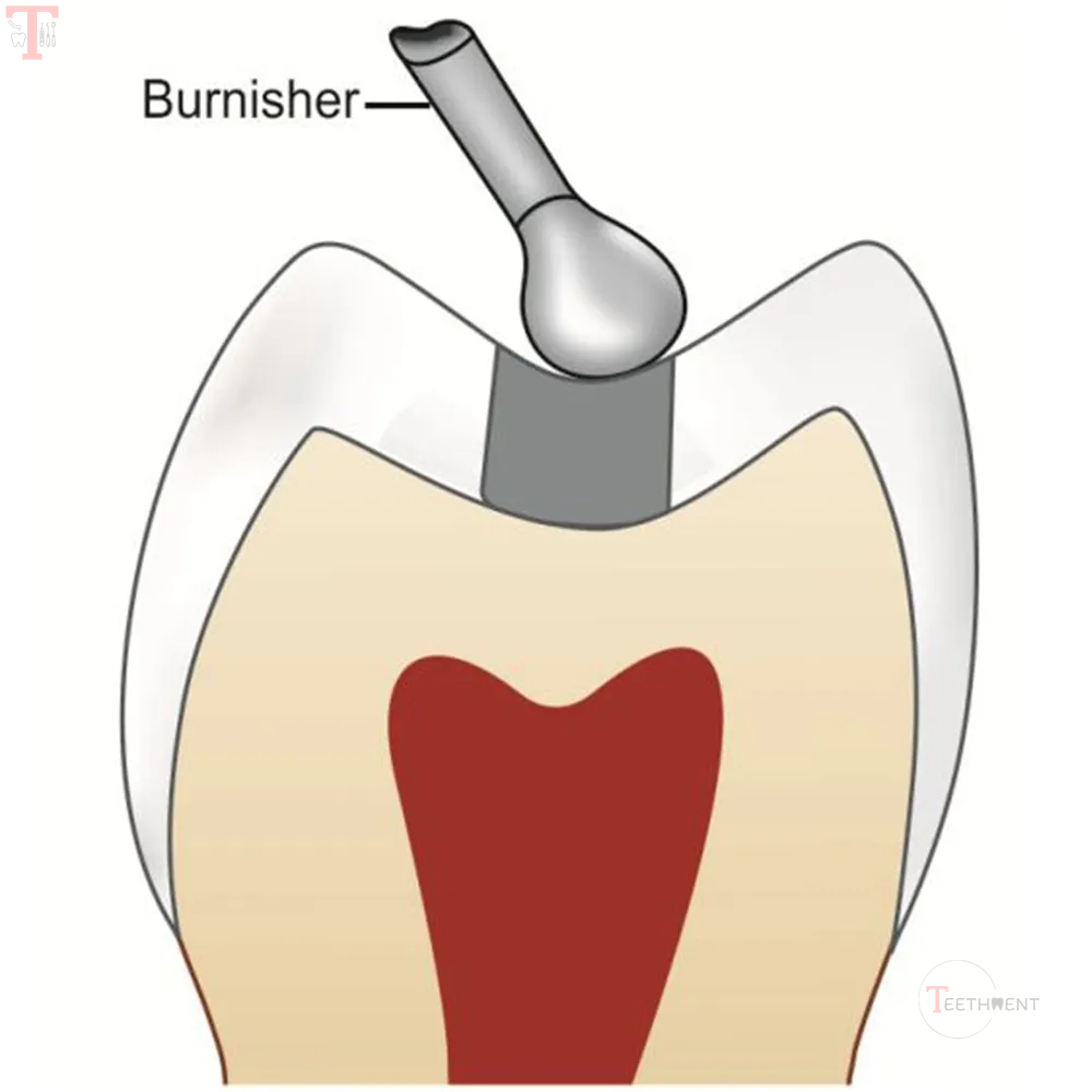 GDC Ball Burnisher  3 BB18_4.jpg