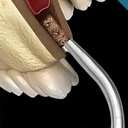 GDC Bone Collector Filter 12mm Bc13312f_4.jpg