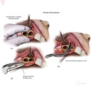 GDC Bone File Howard  12 BF12_4.jpg
