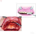 GDC Bone File Howard  12 BF12_5.jpg