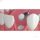 GDC Bone Grafting Instruments_5.jpg