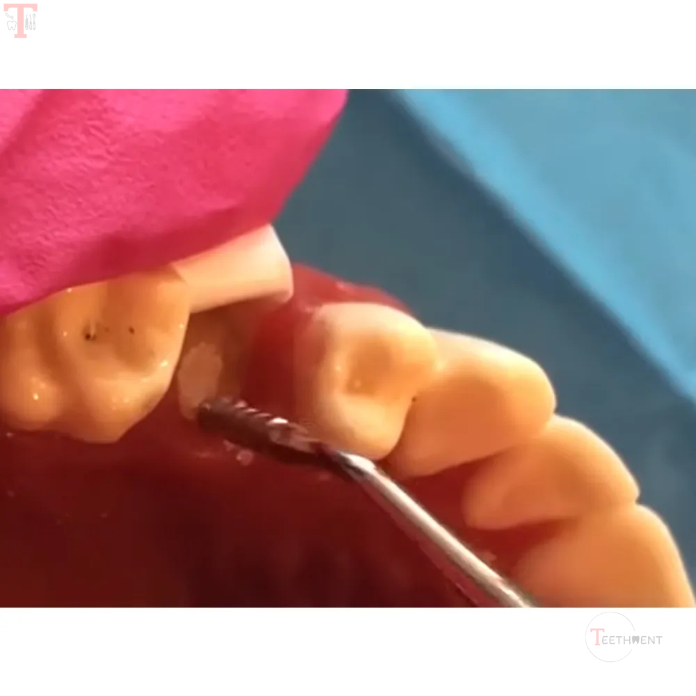 GDC Bone Grafting Instruments_8.jpg
