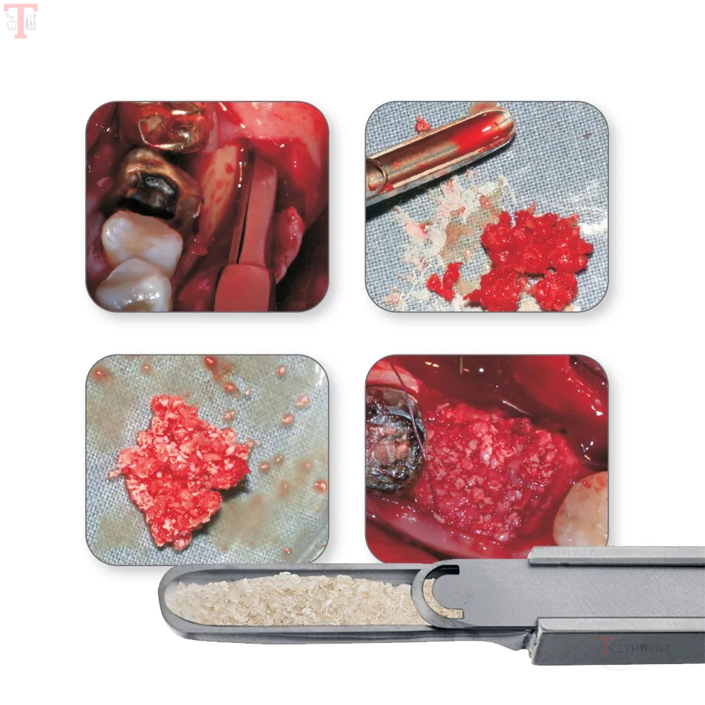 GDC Bone Scraper  Curved Impbc_5.jpg