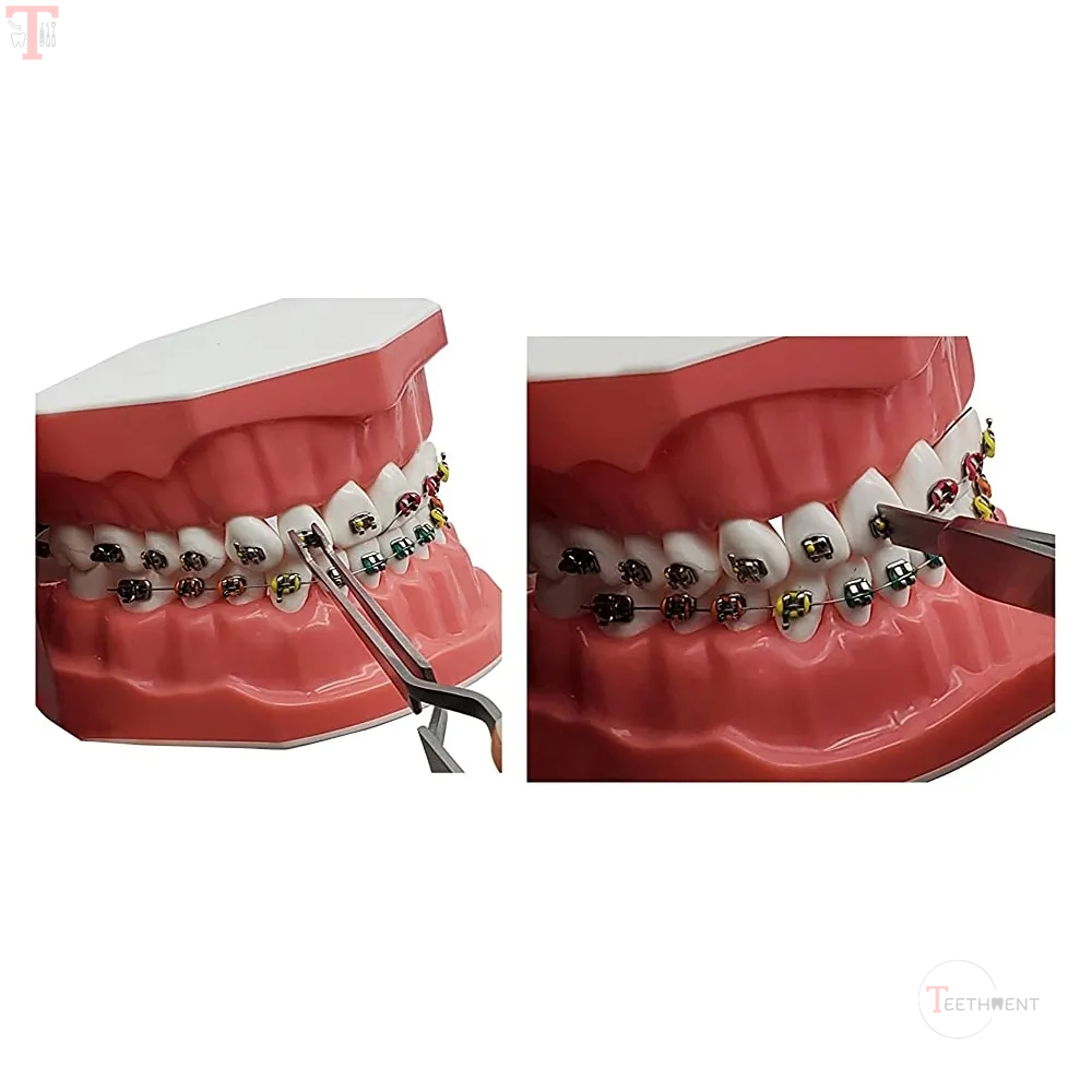 GDC Bracket Holding Tweezer 1008_4.jpg