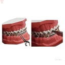 GDC Bracket Holding Tweezer 1008_4.jpg