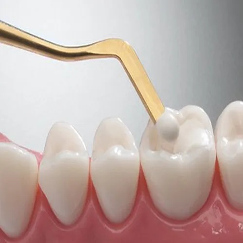 GDC Composite Instrument Gold Titanium 6 CIG1_4.png