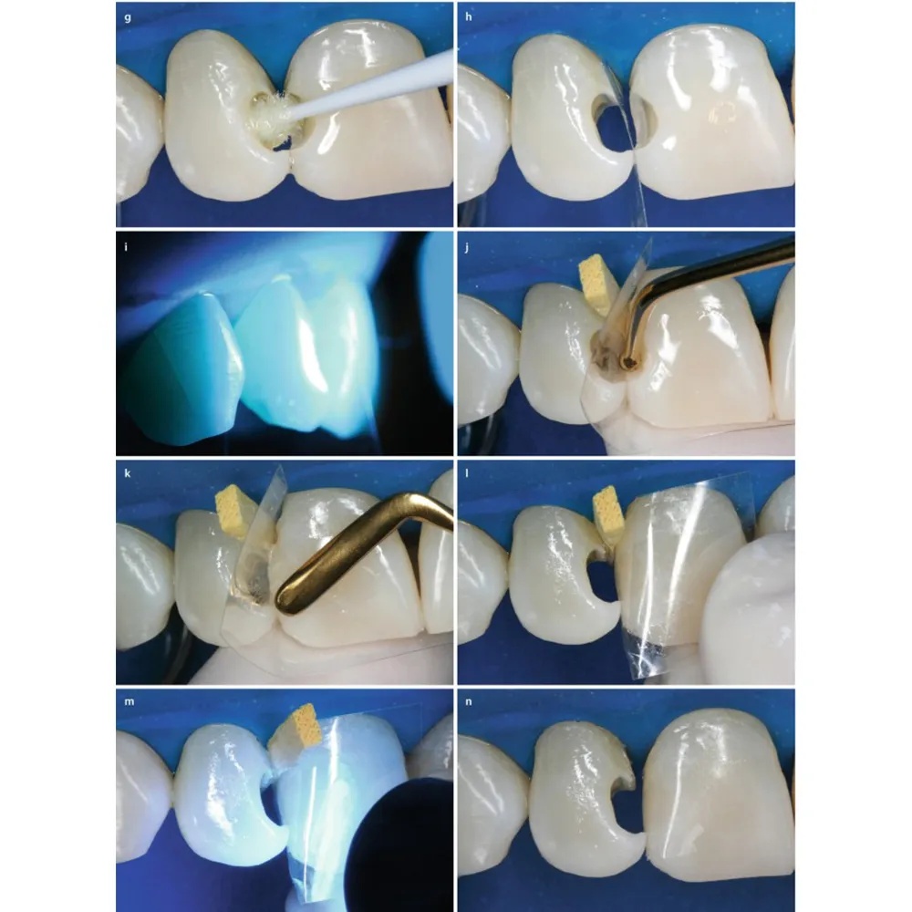 GDC Composite Instrument Gold Titanium 6 CIG1_5.png