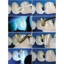 GDC Composite Instrument Gold Titanium 6 CIG1_5.png