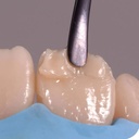 GDC Teflon Coated Composite Anterior Placing Tncipcm_4.png