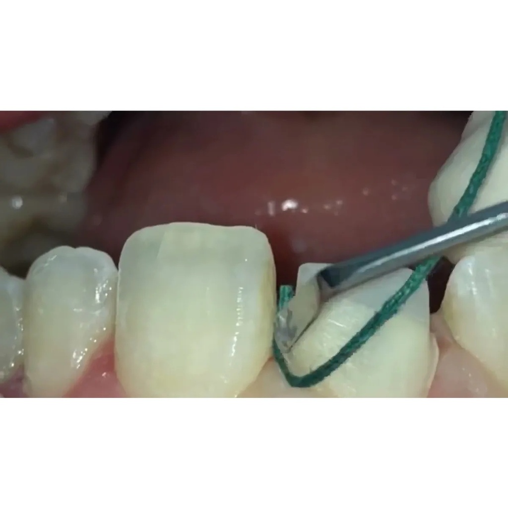 GDC Gingival Cord Packer NonSerrated 4 Gcpr7n_5.png