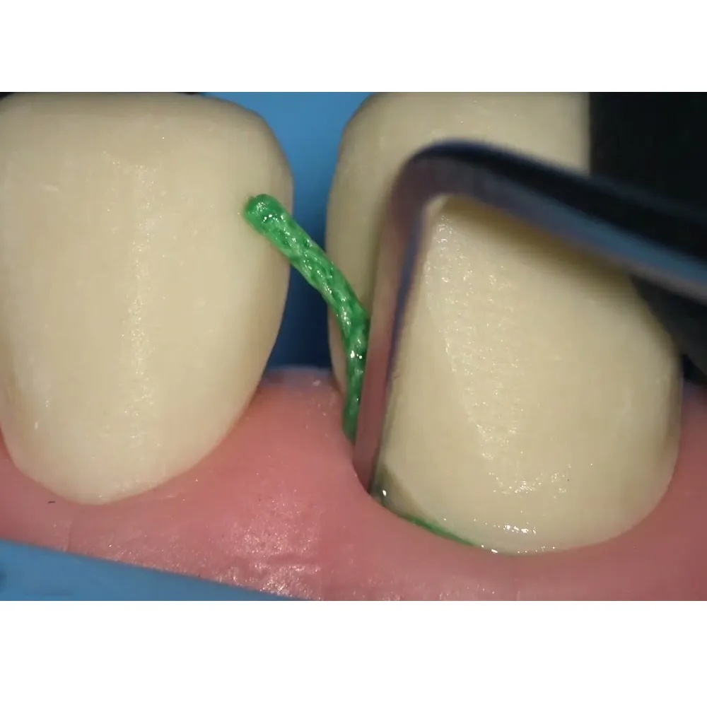 GDC Gingival Cord Packer NonSerrated 4 Gcp113n_5.png