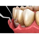 GDC Gracey Curettes Cc Anterior Incisors And Canines  7 Sgcc12_5.png