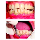 GDC Gracey Curettes 3 Sg1718_5.png