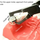 Gdc Posterior Band Remover  Long Tc 300050Tc_5.png