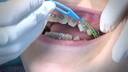 GDC Ortho Elastic Ligature Applicator 1 674_6.png
